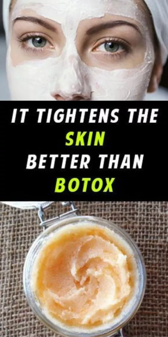 Skin Tightening Homemade Wrinkle Cream That Works Better Than Botox -   10 skin care Homemade wrinkle creams ideas