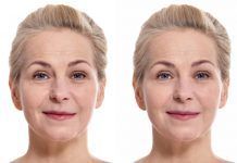 Powerful Homemade Anti-wrinkle Cream to Make Your Skin Younger in 7 Days - ProNutriFIt -   10 skin care Homemade wrinkle creams ideas