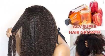 68+ Best ideas hair growth treatment for black women skin care -   11 skin care For Black Women style ideas