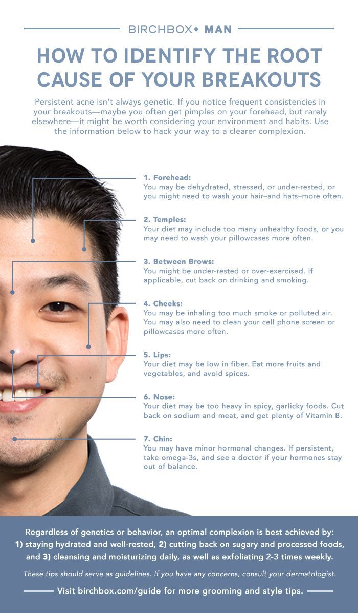 Men's Skincare: How to Identify the Cause of Persistent Pimples -   11 skin care For Men treats ideas