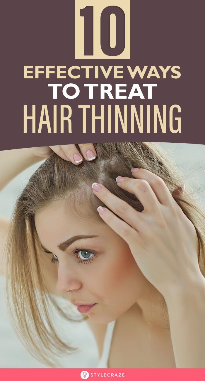 10 Effective Ways To Treat Hair Thinning -   18 hair Fall ideas