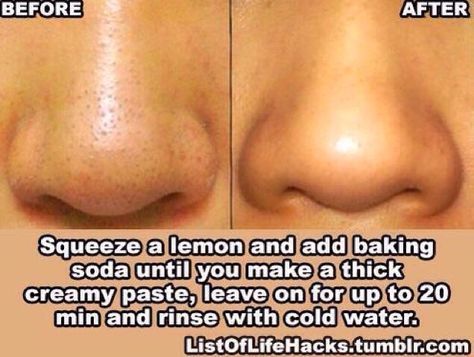 Get Rid Of Large Pores -   16 beauty Hacks products ideas