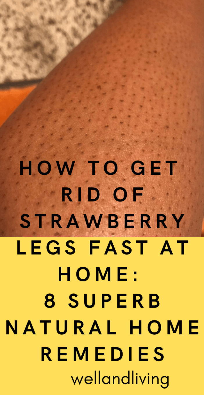 17 how to get rid of strawberry legs fast ideas