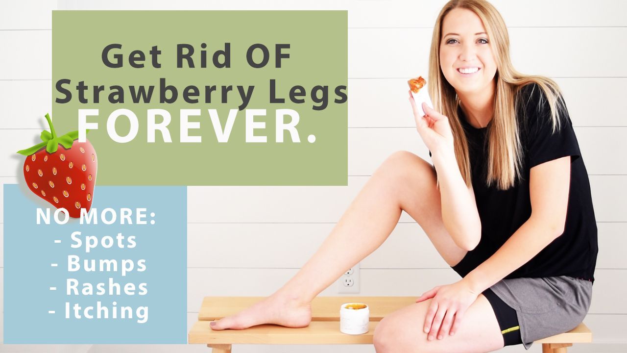Get Rid Of keratosis Pilaris (Strawberry Legs) FOREVER. -   17 how to get rid of strawberry legs fast ideas