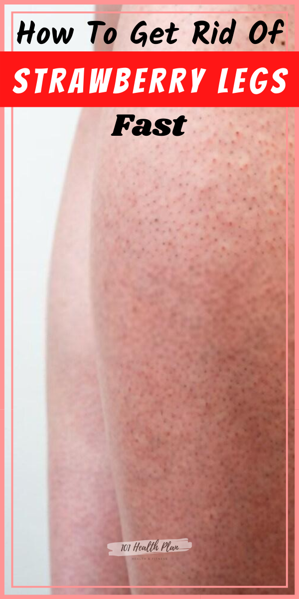 How To Get Rid Of Strawberry Legs Fast - 101 Health Plan -   17 how to get rid of strawberry legs fast ideas