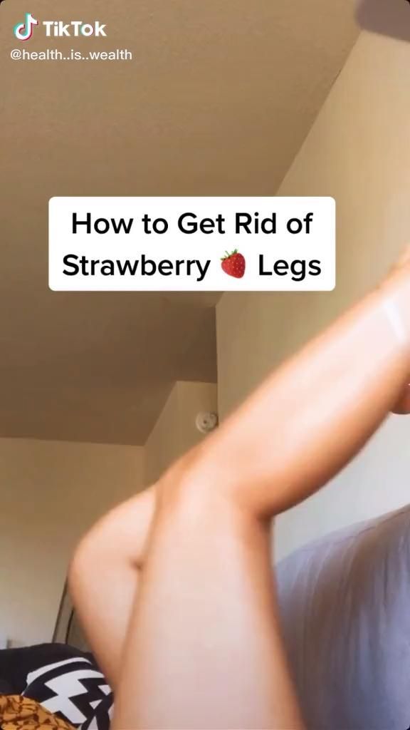 How to get rid of strawberry legs fast! -   17 how to get rid of strawberry legs fast ideas