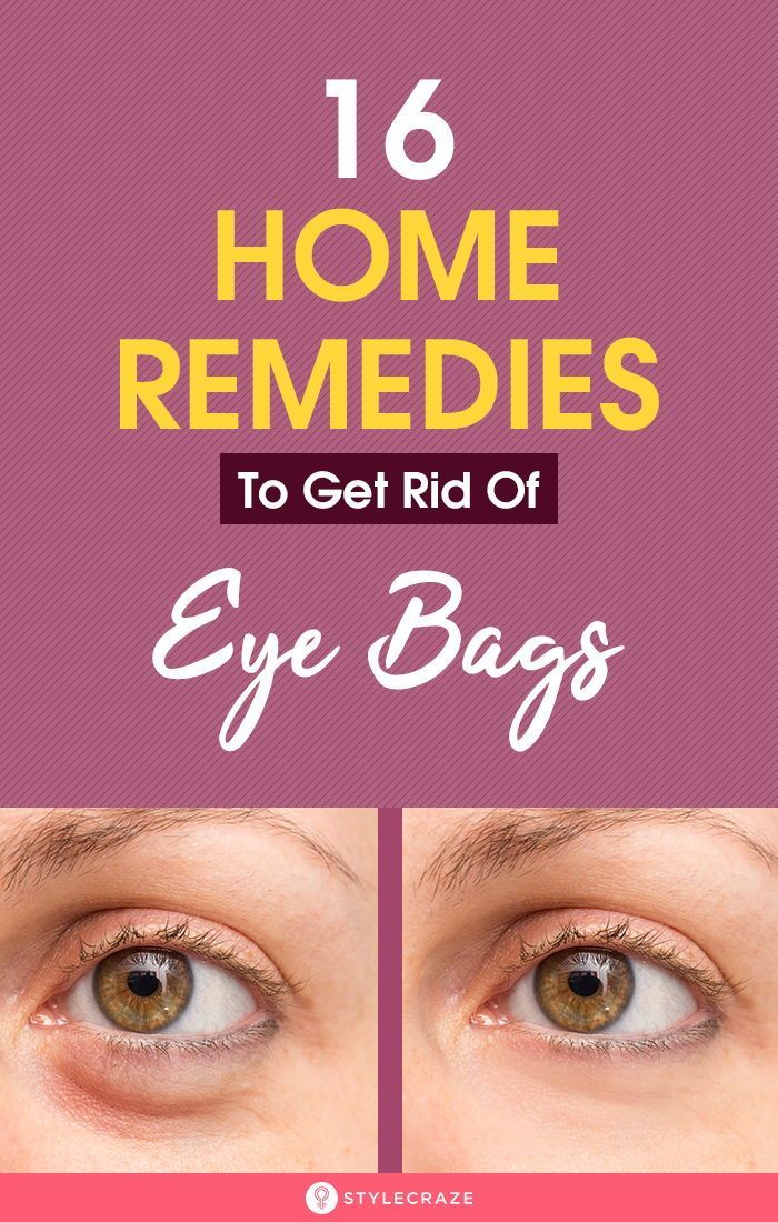 16 Home Remedies To Get Rid Of Eye Bags -   25 how to get rid of bags under eyes ideas